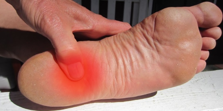 Foot Pain: Causes, Symptoms and Exercises – Posture Doctor